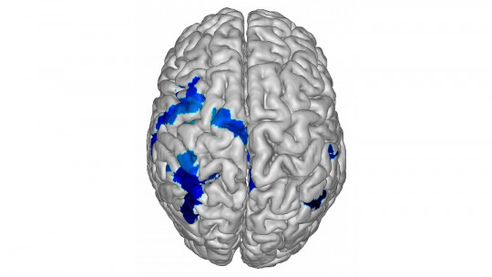 Hemisferio cerebral izquierdo