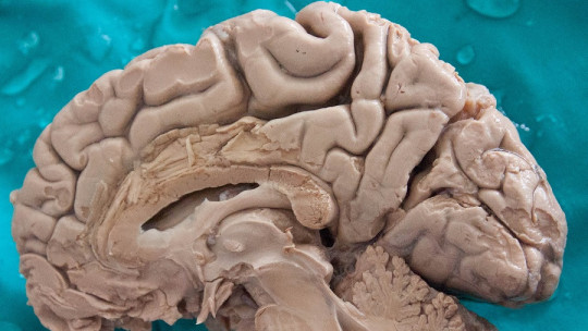 Hemisferio cerebral derecho