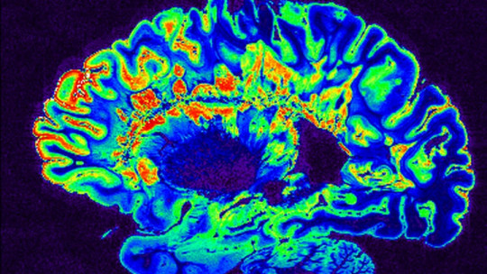 Neurobiología del TDAH