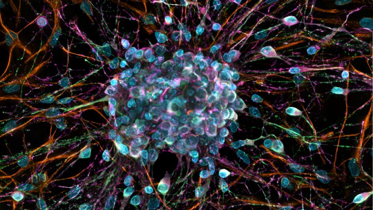 Neurotrofinas