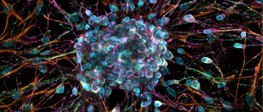 Neurotrofinas