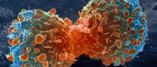 10 mitos populares sobre el cáncer (y por qué son falsos)