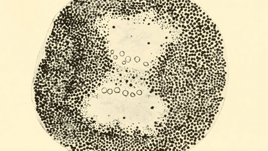 Lisosomas