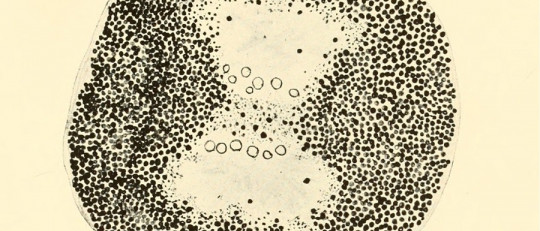 Lisosomas