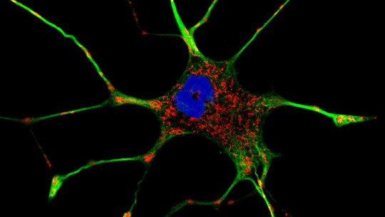 Citoesqueleto de la neurona