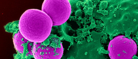 Los 3 tipos de bacterias (características y morfología)