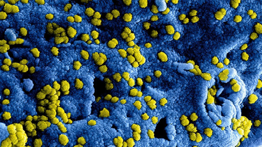 ¿Por qué estudiar Microbiología?