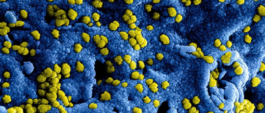 ¿Por qué estudiar Microbiología?