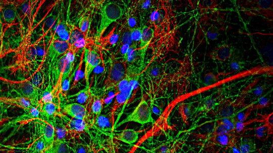 ¿Cómo funcionan las neuronas?