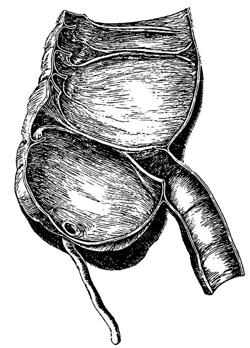 Apéndice del intestino