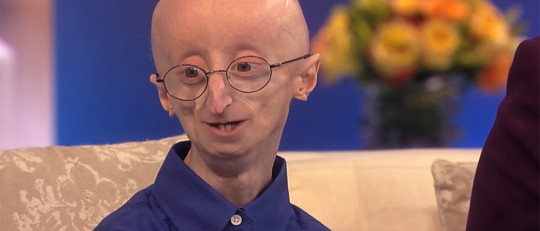 Progeria: causas, síntomas y tratamiento