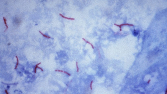 Baciloscopia