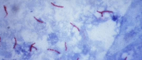 Baciloscopia