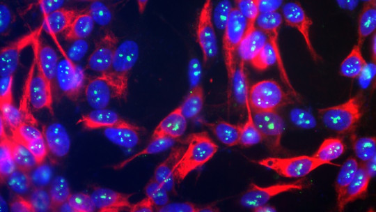 Neurofilamentos