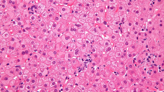 Hepatocitos