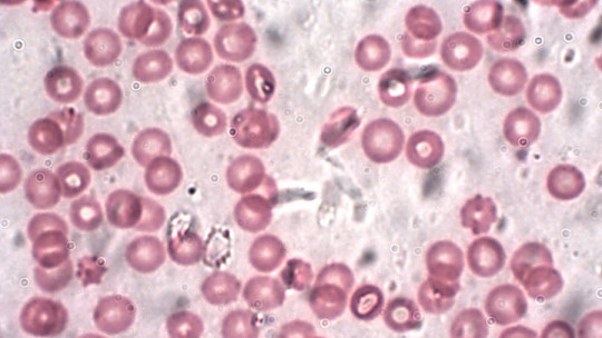 Hemocateresis