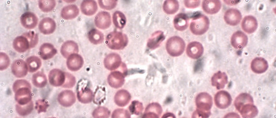 Hemocateresis