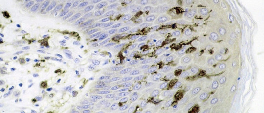 Células dendríticas