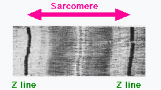 Sarcómero