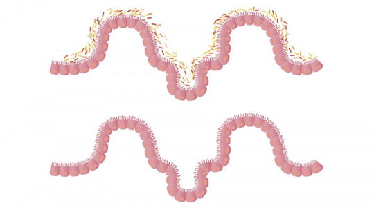 Flora intestinal