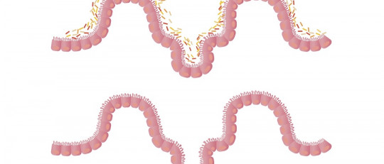 Flora intestinal