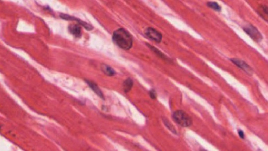 Fibra muscular