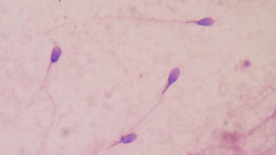Espermatogénesis