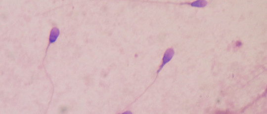 Espermatogénesis