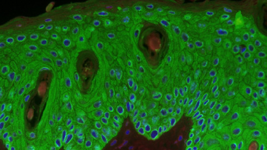 Queratinocitos