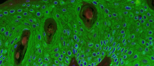 Queratinocitos