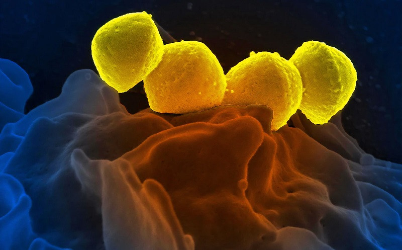 Bacterias