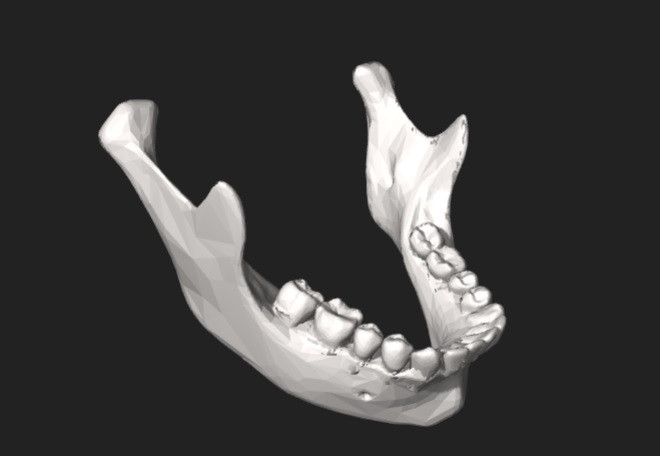 Maxilar inferior