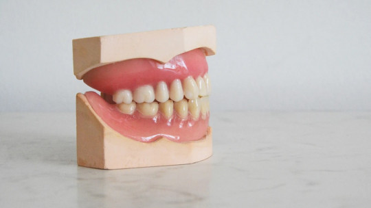 Tipos de dientes