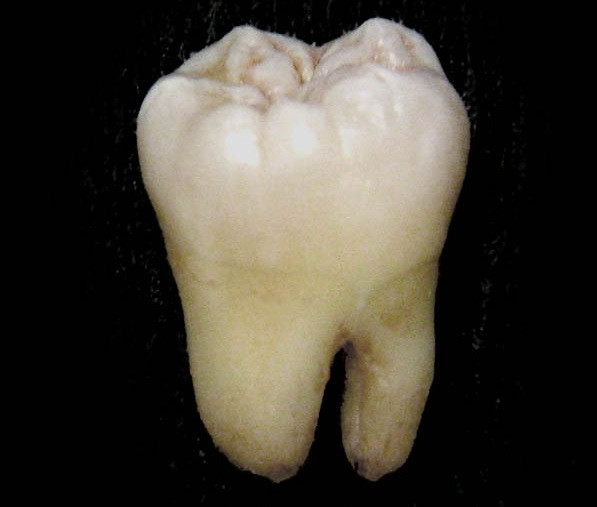 Molar