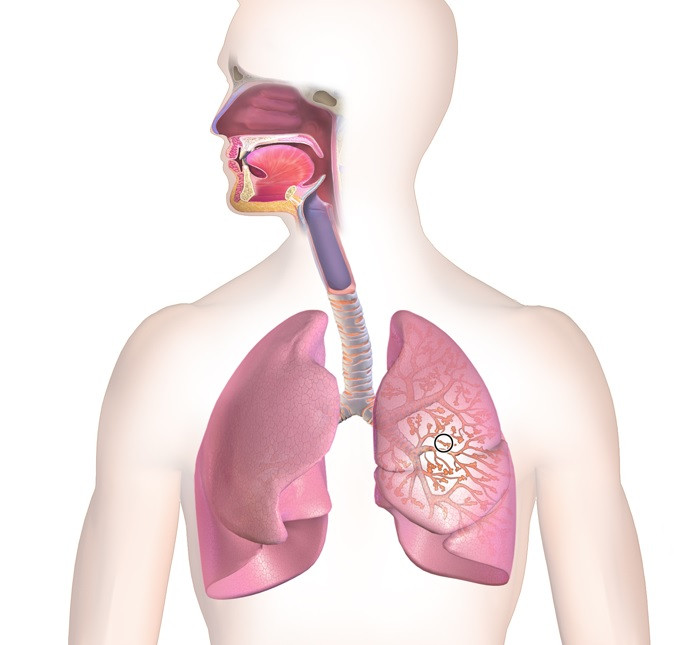 Bronquitis