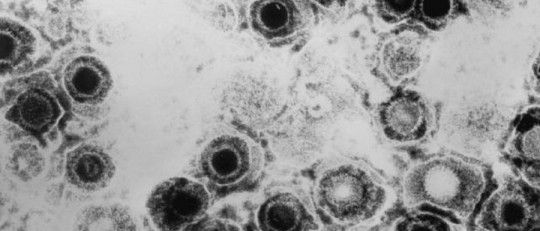 Tipos de herpes