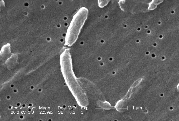 Bacteria