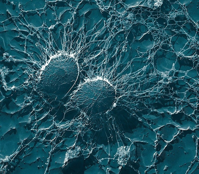 Bacterias coco