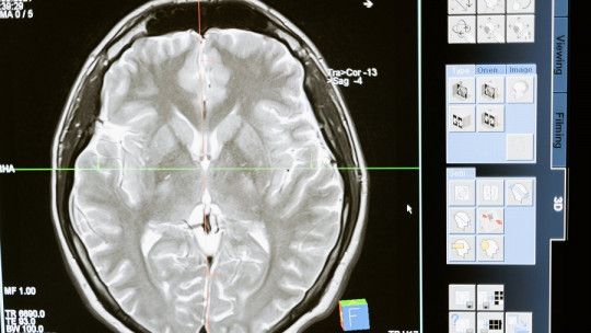 Cerebro reptiliano