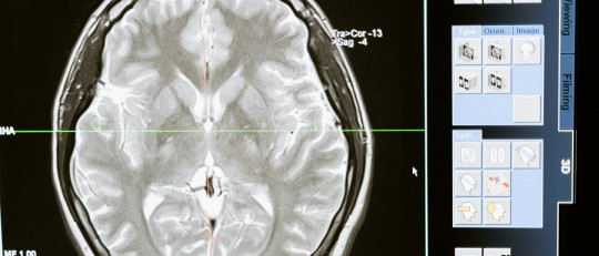 Cerebro reptiliano